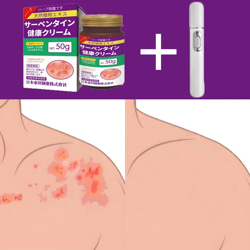 

Professional Shingles Detection Instrument - High Accuracy