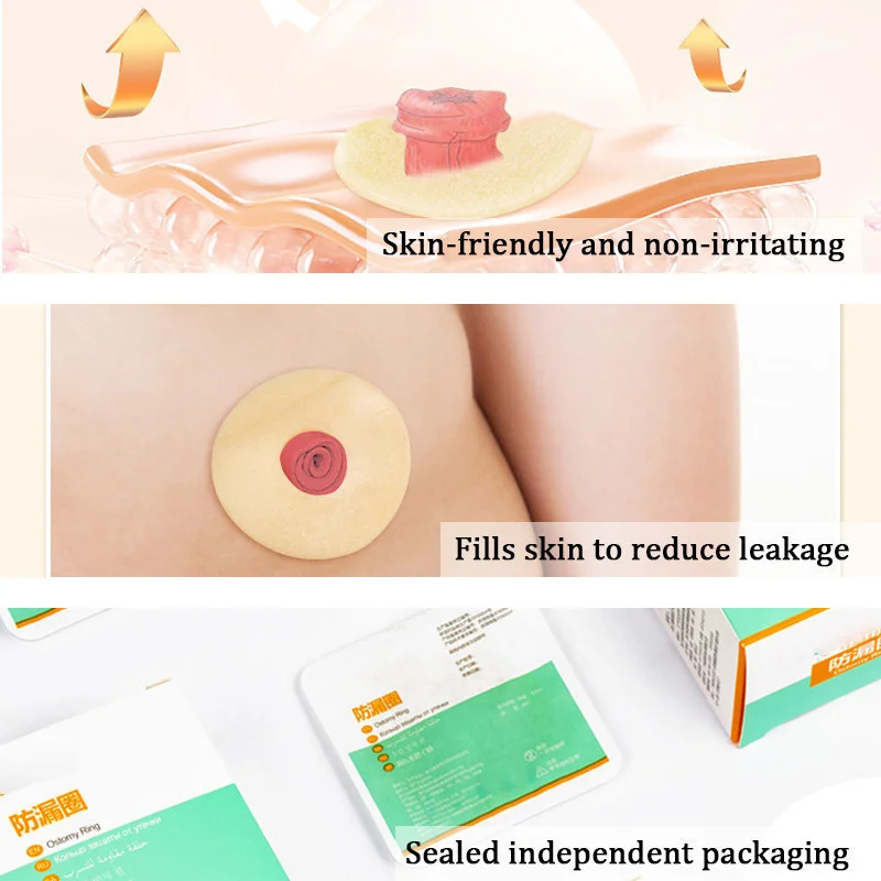 10 Pcs/box Colostomy Bag/urostomy Bag Leak-Proof Ring Leak-Proof Patch Ring Attachment Glue for Fistula Opening Chassis