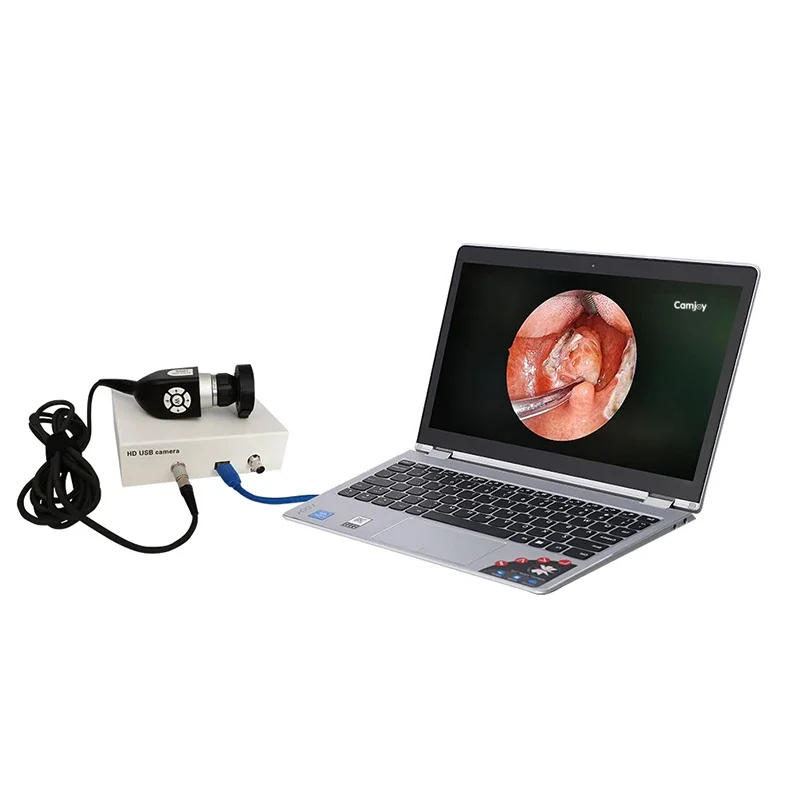 

Medical CMOS portable usb endoscopy endoscope HD for ENT