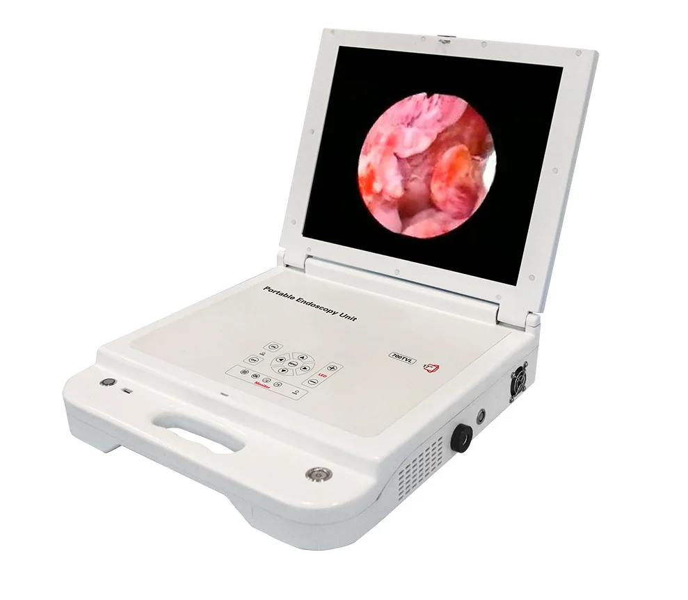 MT MEDICAL Medical Hospital Rigid Portable Video Laryngoscope Price Endoscope Camera Laryngoscope Ent Instruments