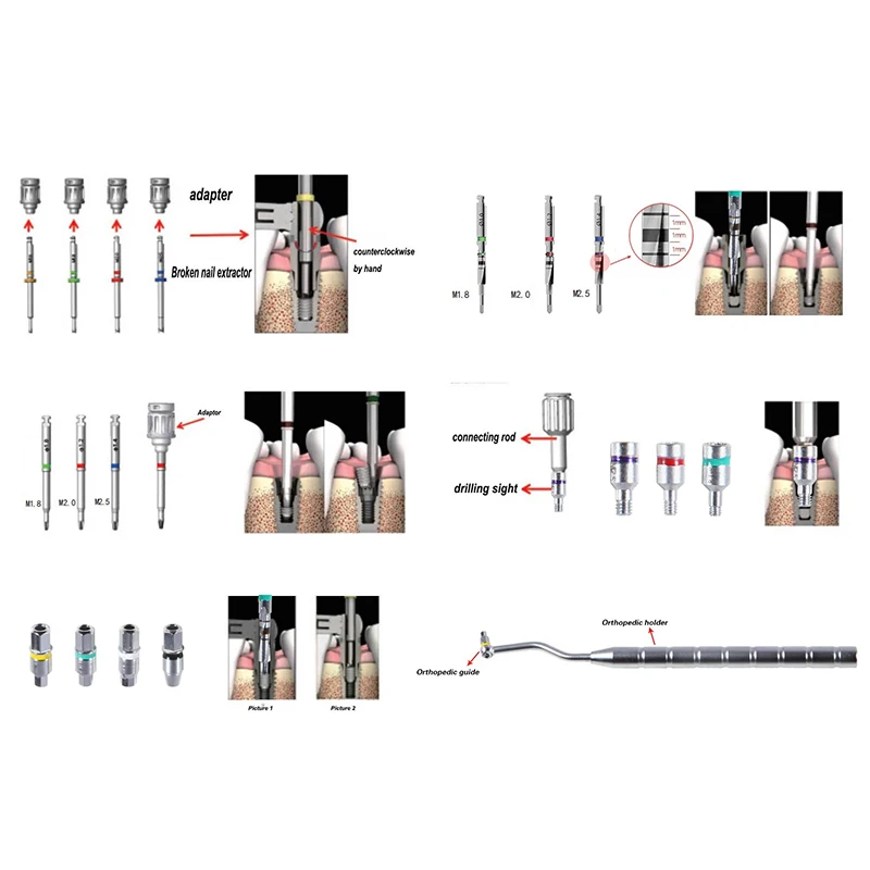 VVDental Dental Implant Fractured Broken Screw Remover Kit Implant &Fractured Screw Removal Kit Universal Implant