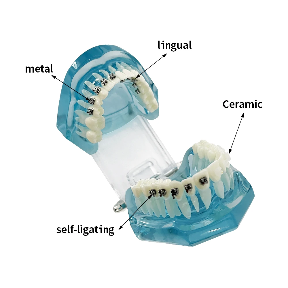 Dental Orthodontic Teeth Model with Ceramic Metal Self-Ligating Bracket Lingual Four Brackets Comparison Models Dentistry Teachi