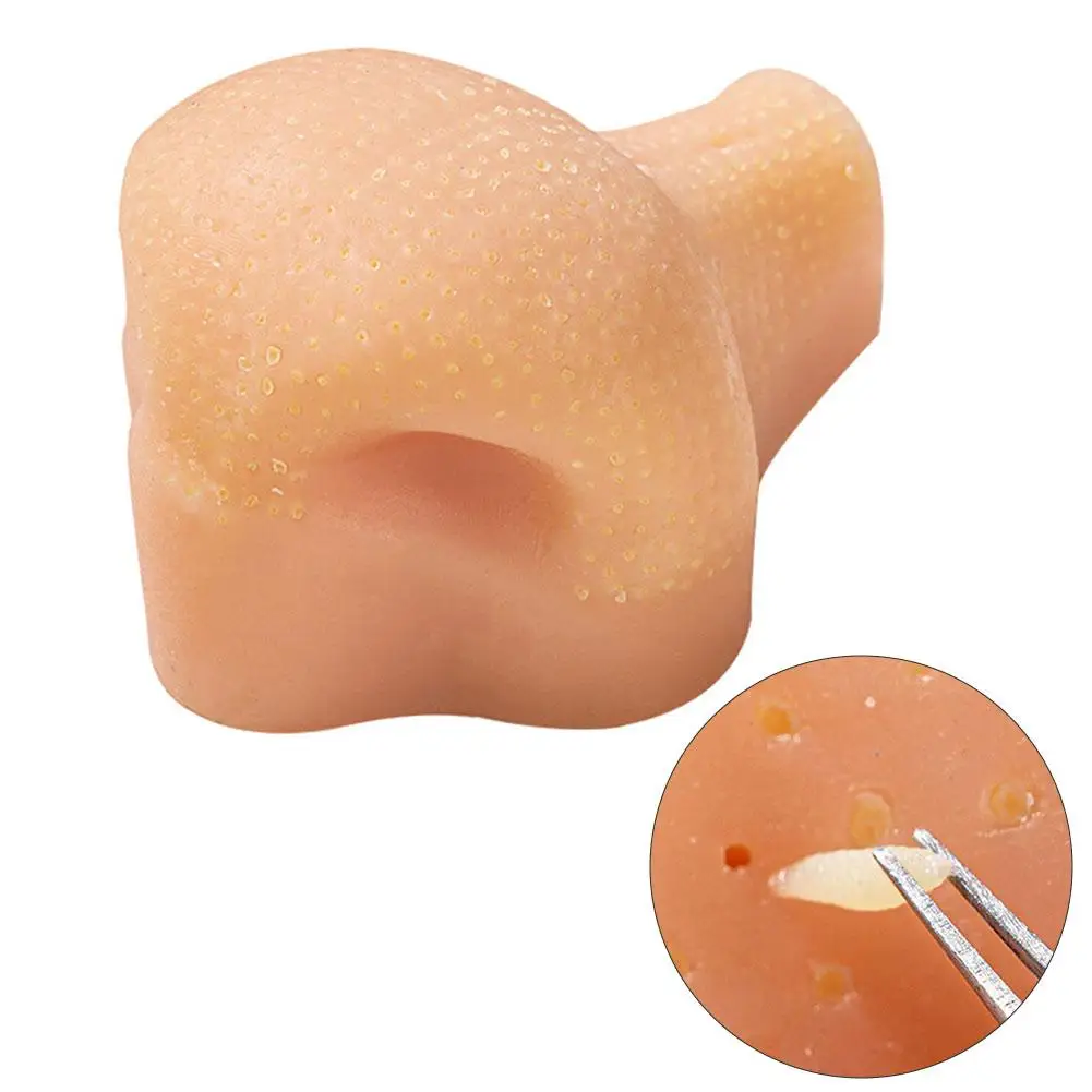 Realistic Pimple Popper Fidget Toy Reusable Sensory Stress Reliever For Anxiety Simulation Blackhead Squeezing Model