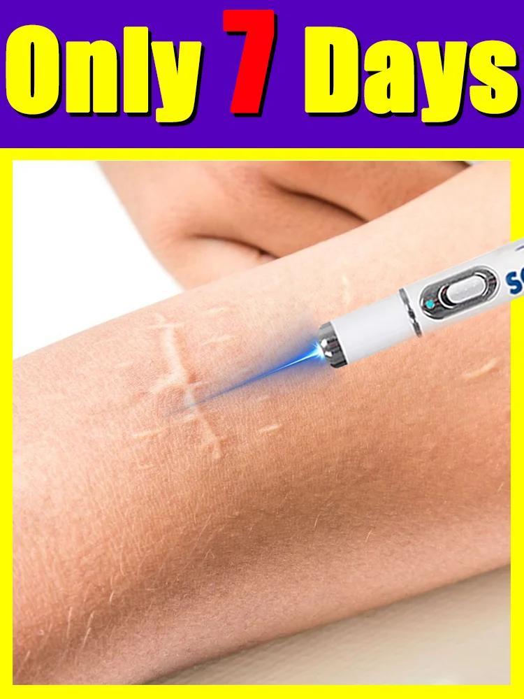 

blue light pen solve scar,scar care tools,painless,free shipping,unisex