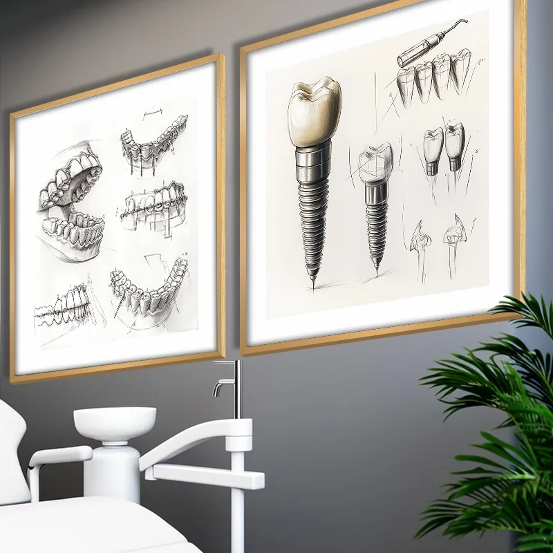 Tooth Implant Anatomy Dental Oral Clinic Orthodontics Posters Pictures Canvas Wall Art Home Decor for Living Room Decoration