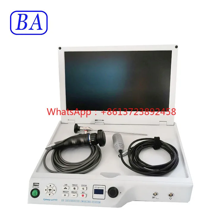 Professinal Surgical New Type Endoscopy Integrated gynecology endoscope