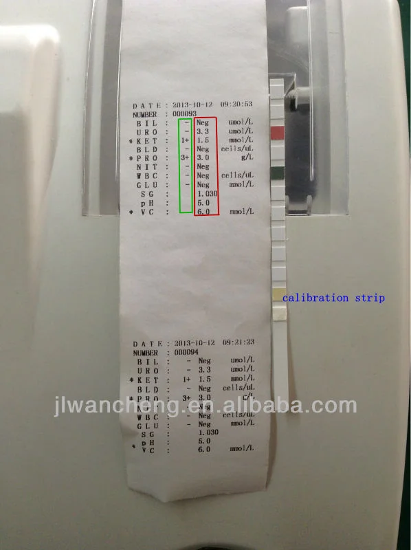 Fully-Auto Hematology Analyzer Urine Clinical Analyzer