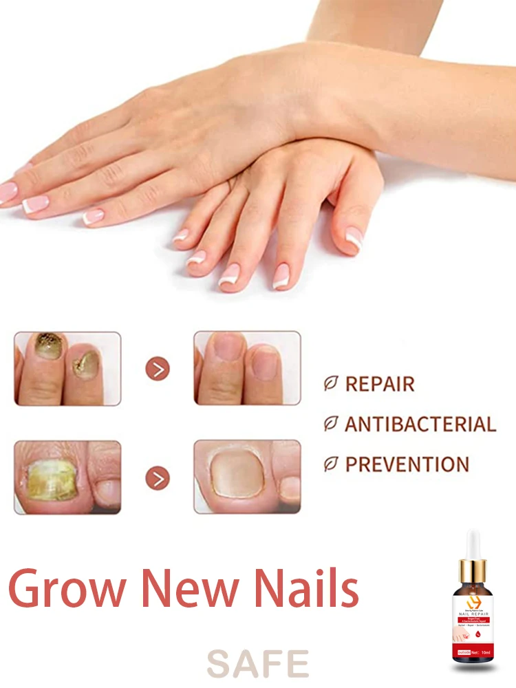 

All nails trouble solved