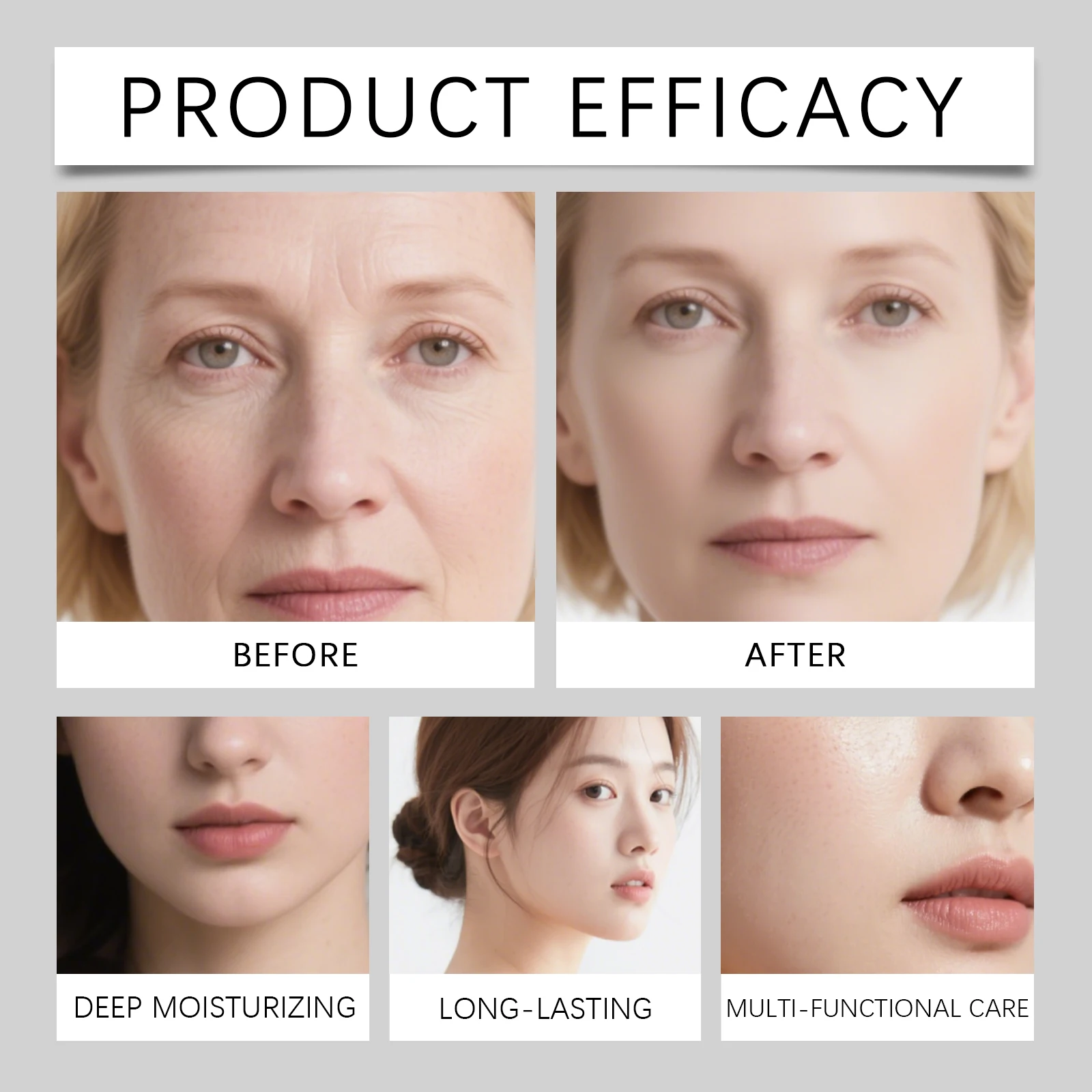 95% Sodium DNA PDRN Volume Fill-it Booster Neck&Facial Cream Adenosine Fine Lines Refining Cream Anti Aging Facial Moisturizer Skin Texture Smoothing Elasticity Restoring Barrier Repair Deep Hydrating Korean Skincare Tube 30g
