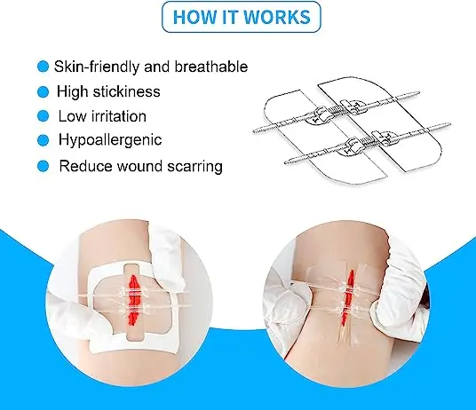Wound Closure Strips Butterfly Bandages First Aid Adhesive Stitch Sutures