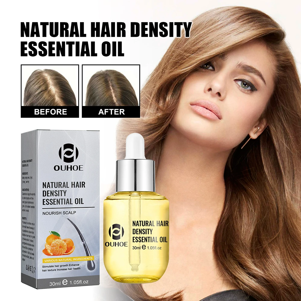 

Натуральное эфирное масло для роста волос, имбирная эссенция, лечение роста волос, утолщение волос, против выпадения волос, подарочный набор для мужчин и женщин