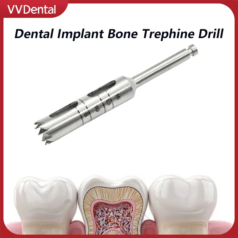 VVDental Dental Implant Bone Trephine Drill 3-7mm 5 Sizes Bone Collector Trephine Bur Stainless Steel Surgical Instrument