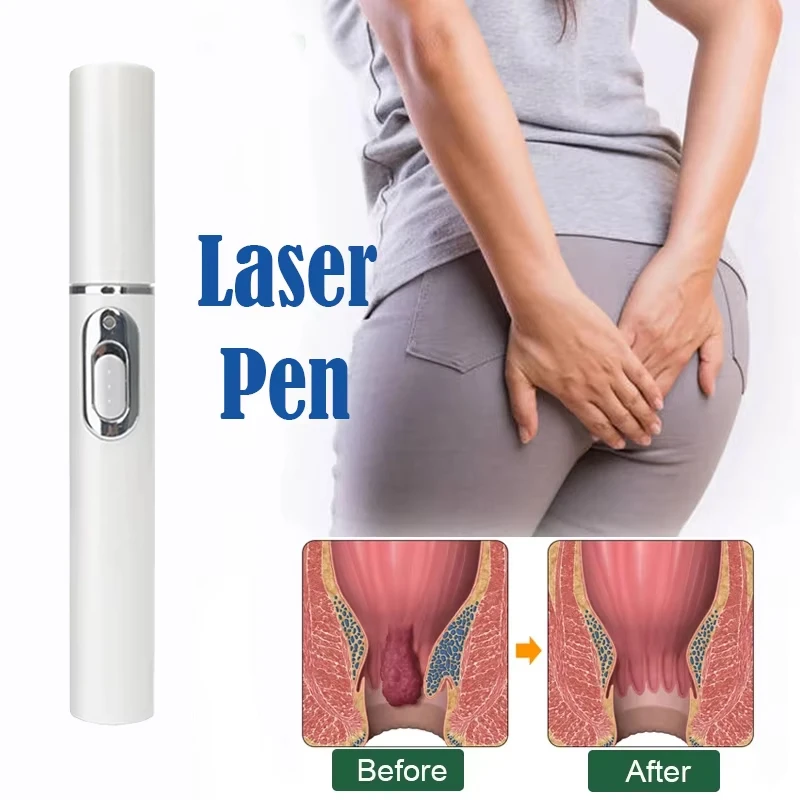 Hemorrhoid Medical Laser Pen Repair Anal Soft Tissue Stop Bleeding Effective Anti Swelling Pain Relief Laser Pointer Health Care