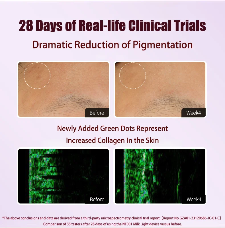 أداة تجميل الوجه RF مدلك رفع الرقبة التنظيف العميق بالموجات فوق الصوتية جهاز تجميل الوجه تبييض البشرة