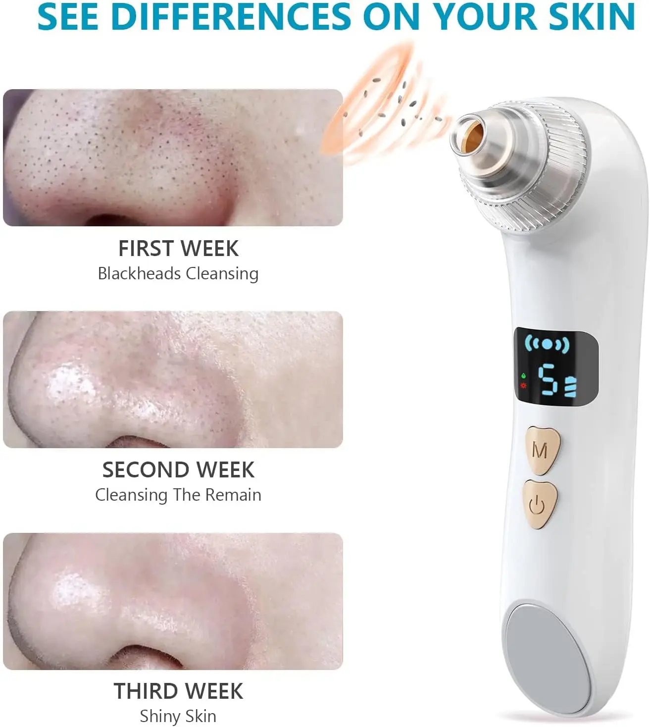 Aspirapolvere per la rimozione dei punti neri con display a LED, 6 sonde sostituibili, 3 modalità di riscaldamento, 5 livelli di aspirazione, adatto per donne e uomini