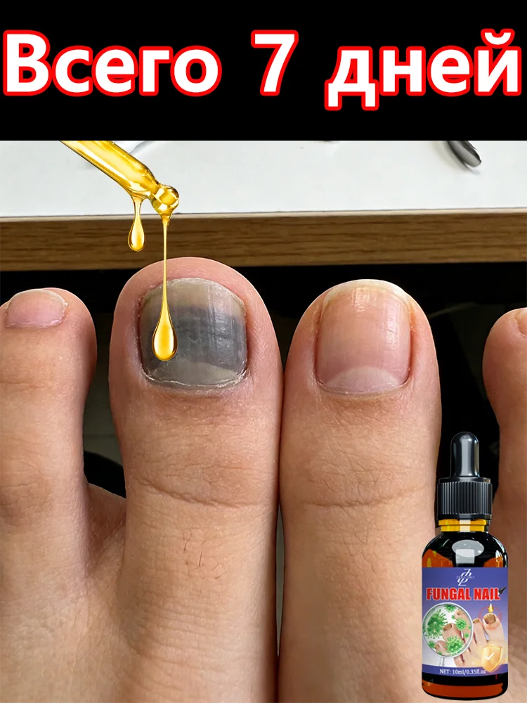 

Nail Fungus Serum Natural Nail Repair Essence Nourishing Brightening For Discolored Brittle Nails Onychomycosis Paronychia Care