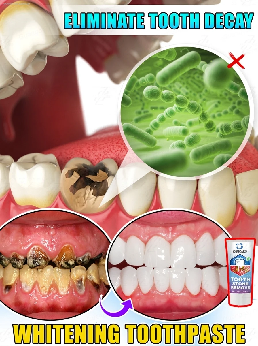 

Using it once in the morning and once at night can easily repair small cavities.