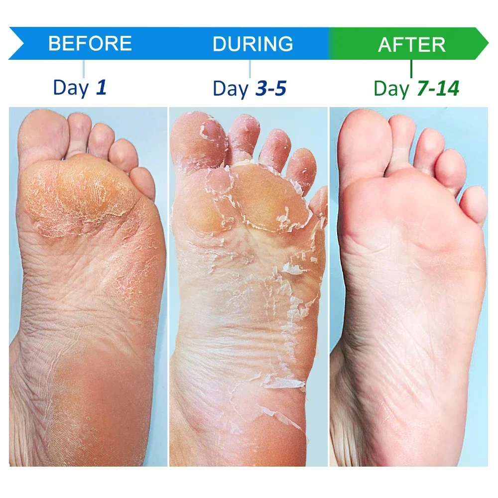 Anti Crack Hand Foot Cream Anti-Drying Heel Cracked Repairs Feet Mask Removal Dead Skin Moisturizing Whitening Smooth Feet Care