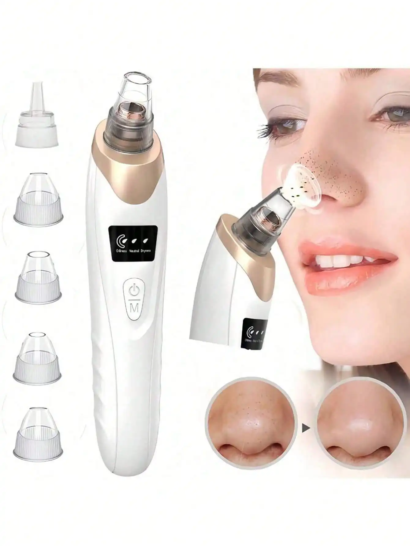 1 Blackhead Remover Pore Vacuum Cleaner, Facial Pore Cleaner, 5 Suction Heads, 3 Suction Forces, Vacuum Cleaner USB Rechargeable