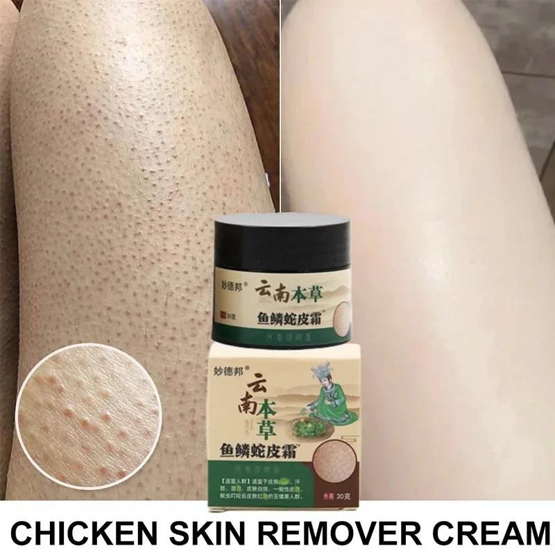 30ml Curing Keratosis Pilaris Repair Cream Chicken Follicle Skin Body Scrub Dark Spots Remove Smooth Moisturize Whitening Creams