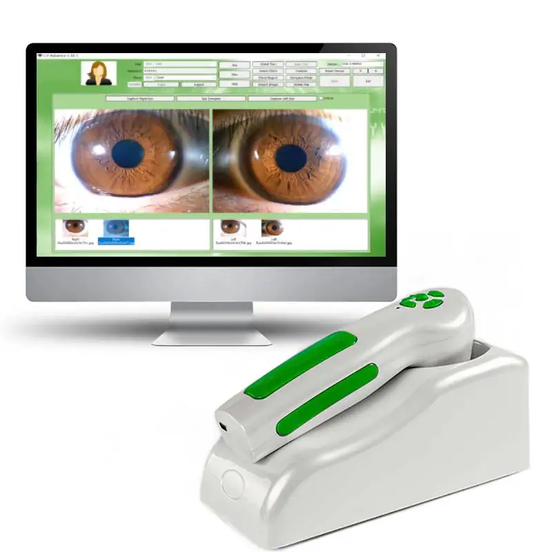 Cámara profesional de iridología ocular, Analizador de Iris HD de 12MP para salones de belleza y clubes de salud