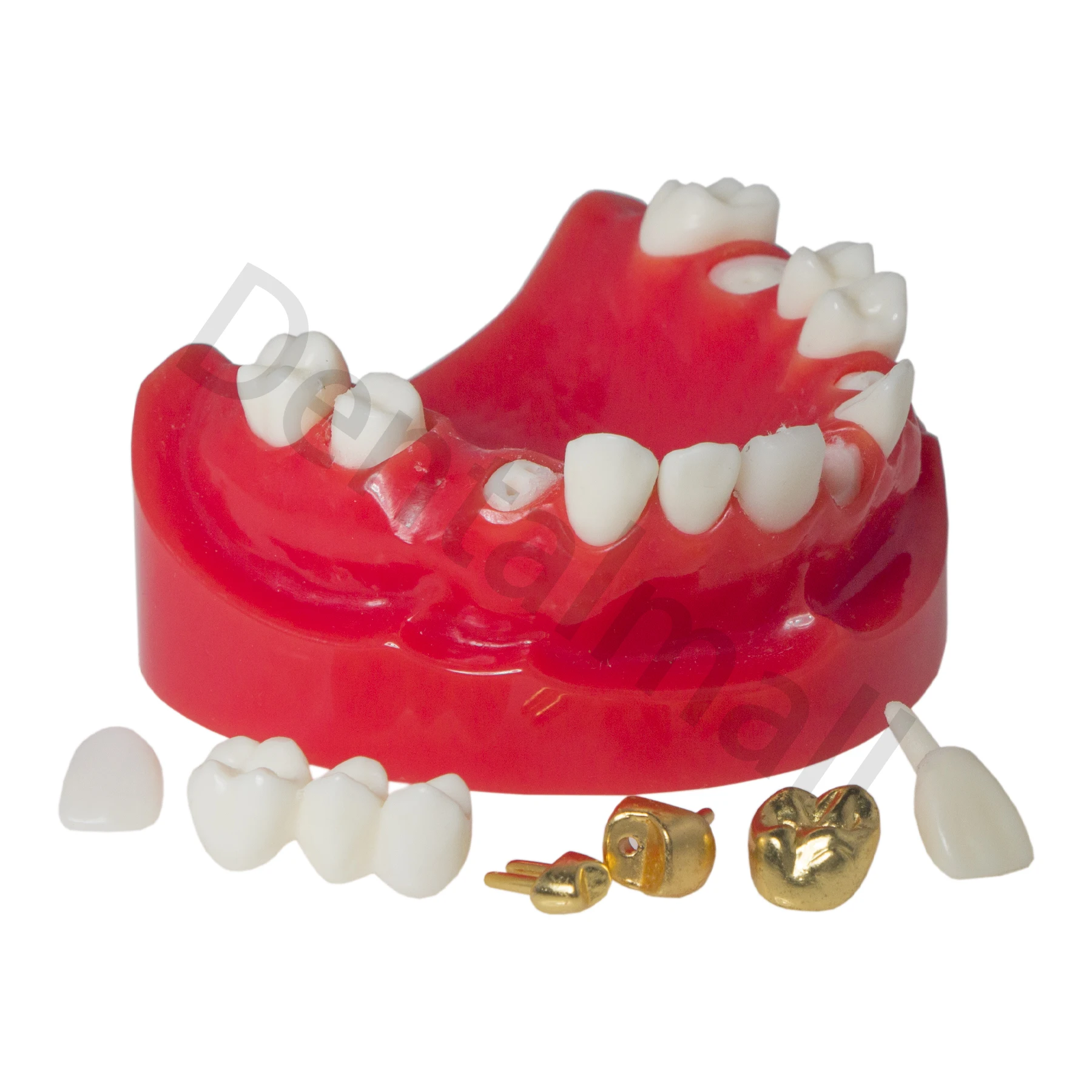 Typodont Teeth Model M6004 Model with Endodontics Restoration Learning and Teaching Demonstrate
