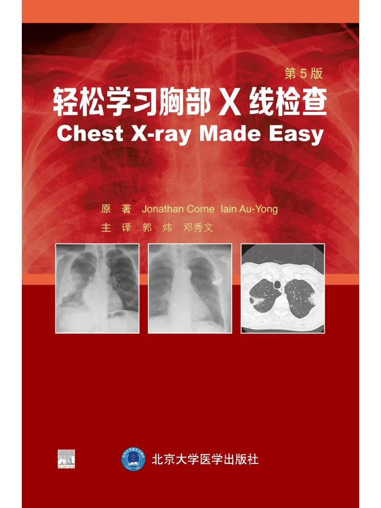 

Book-Winshare Easy Guide To Chest X Ray Examination 5th Edition