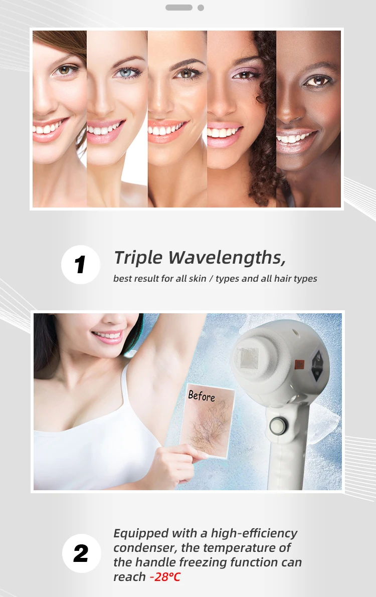 Effective Painless Laser Portable Triple Wavelength 808nm 755nm 1064nm Hair Removal Machine Excellent cooling for all skin types