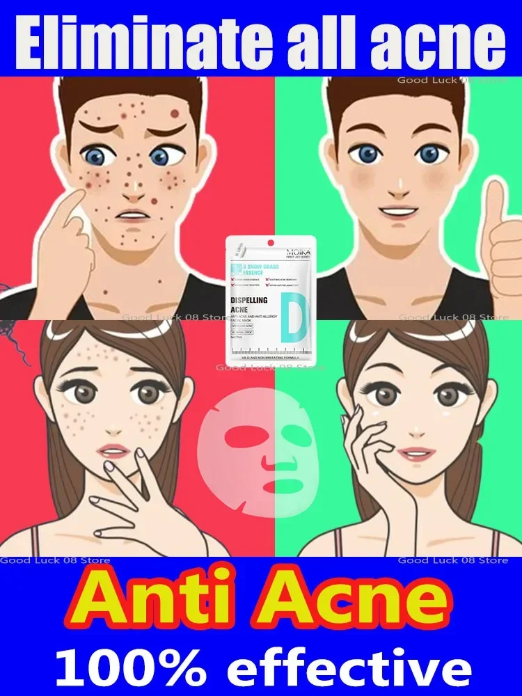 Remoção anti-acne