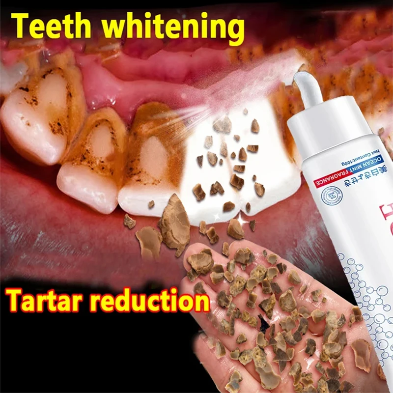 New Dental Calculus Remover Toothpaste Whiten Teeth Removing Mouth Odour Yellow Teeth Preventing Periodontitis Dental Cleansing