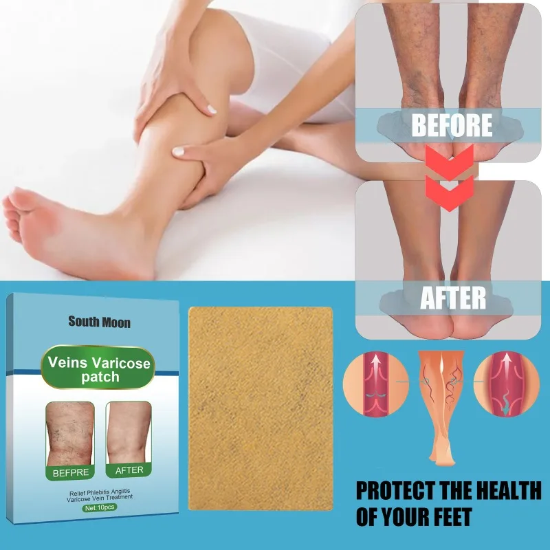 Varicose Vein Treatments Patches Effective Relieve Legs Dilated Vasculitis Phlebitis pain sticker For Varicose Veins care patch