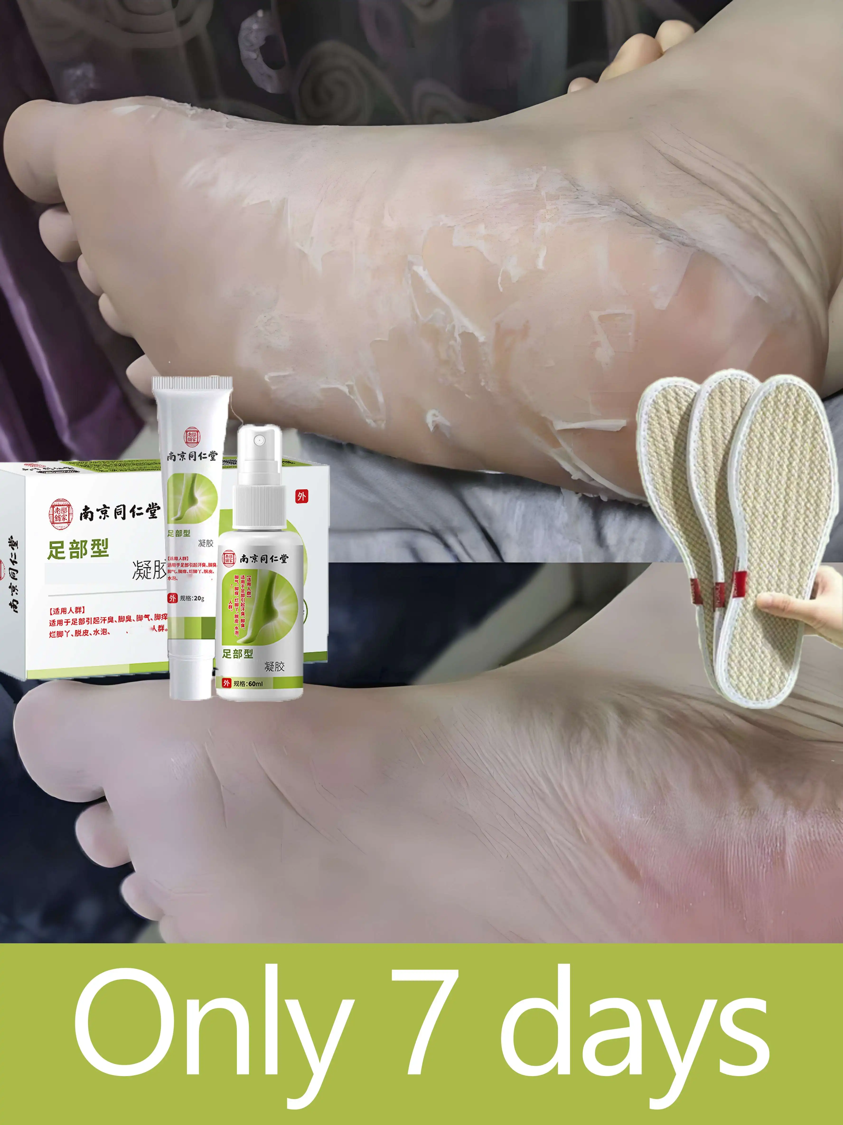 

Premium Foot Fungus Remover - Luxury Design & Performance​