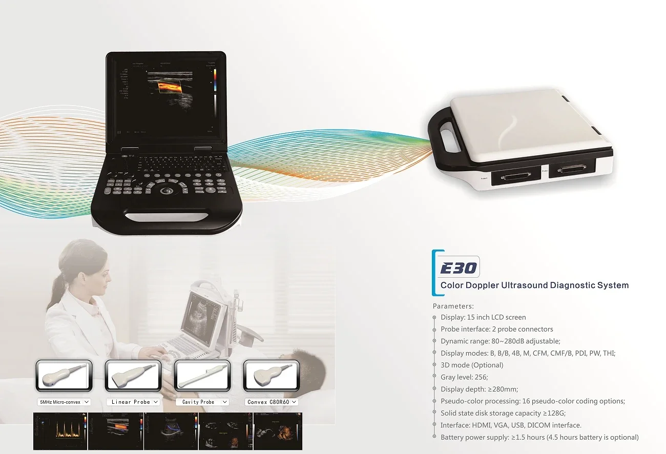 

E30 Veterinary Colour Doppler Ultrasound Diagnostic System Portable Veterinary Colour Ultrasound Machine