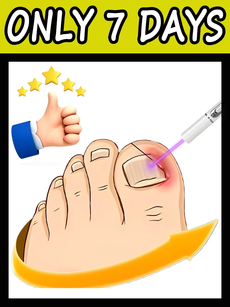 Niebieskie światło eliminuje grzybicę paznokci i przywraca zdrowie paznokci.