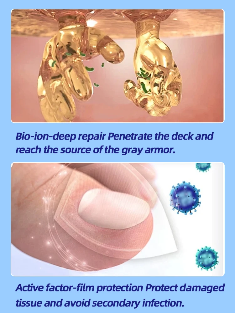 Óleo essencial para tratamento de fungos nas unhasrepara onicomicose em 7 dias