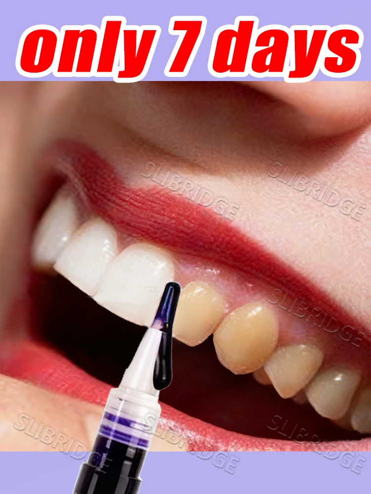 

purple pen Set free shipping, helping people who suffer from Want to get bright white solve their problems