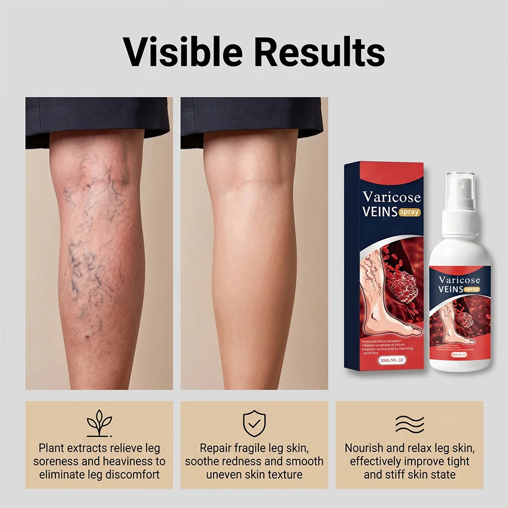 Varicose Vein Spray Fast Relief For Tired Legs Targeted Relief For Bulging Vein Leg Heaviness Fatigue For Leg Soreness