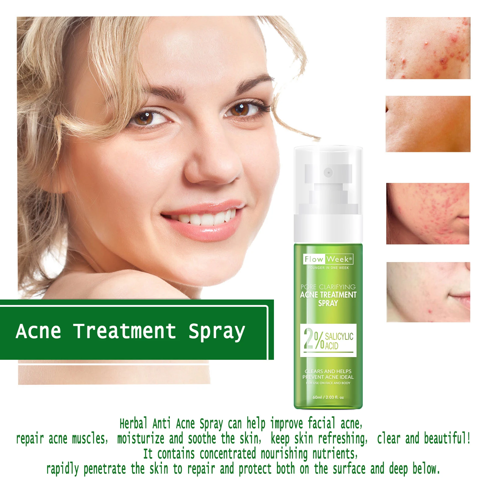

FlowWeek Salicylic Acid Acne Spray Acne Cream Back Pimple Removal Spray Face and Body Acne Spray Acne Treatment