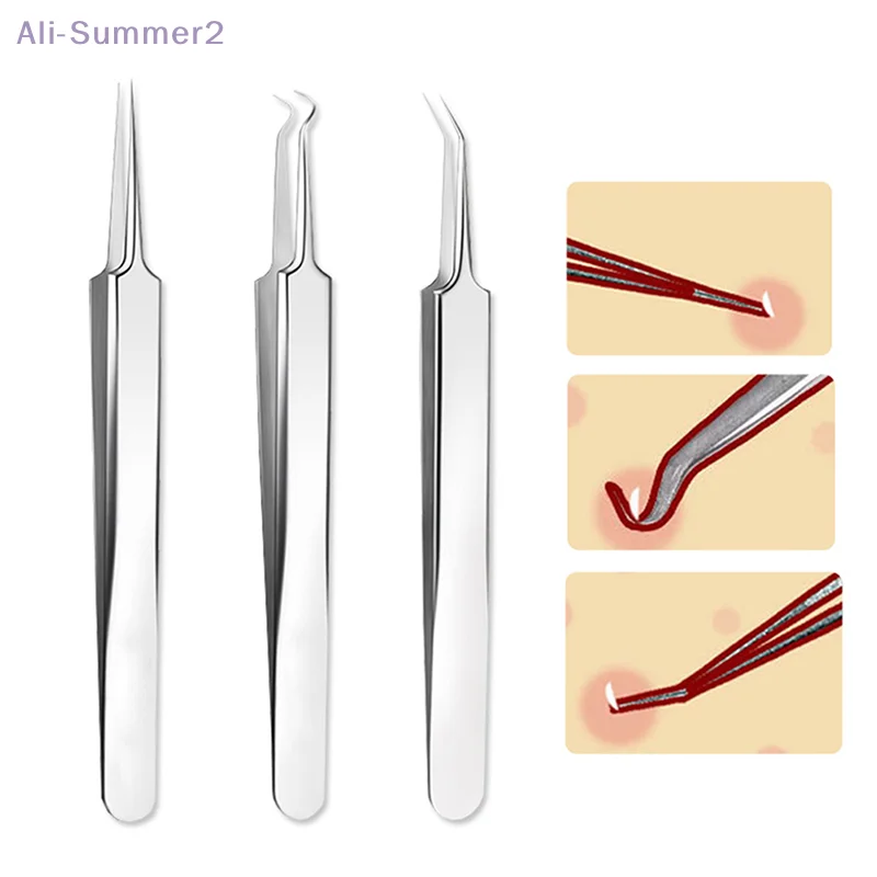 Pointed/Bend Clip Stainless Steel Tweezer Blackhead Pimples Removal Comedone Extractor Acne Needle Protector Face Care Tools