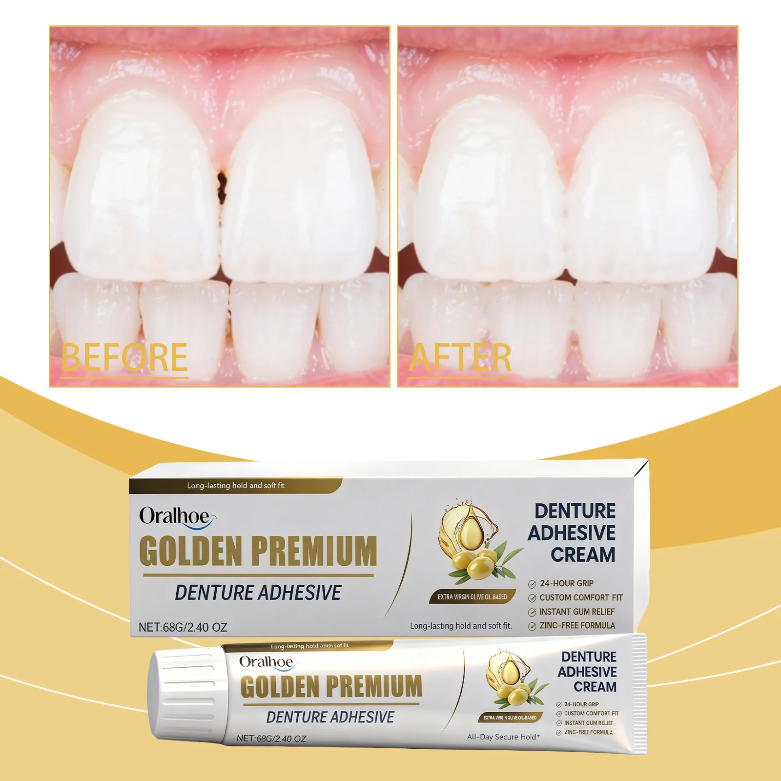 Oralhoe Denture Fixing Adhesive Denture Decoration Oral Teeth Beautiful, Natural and Comfortable Improvement