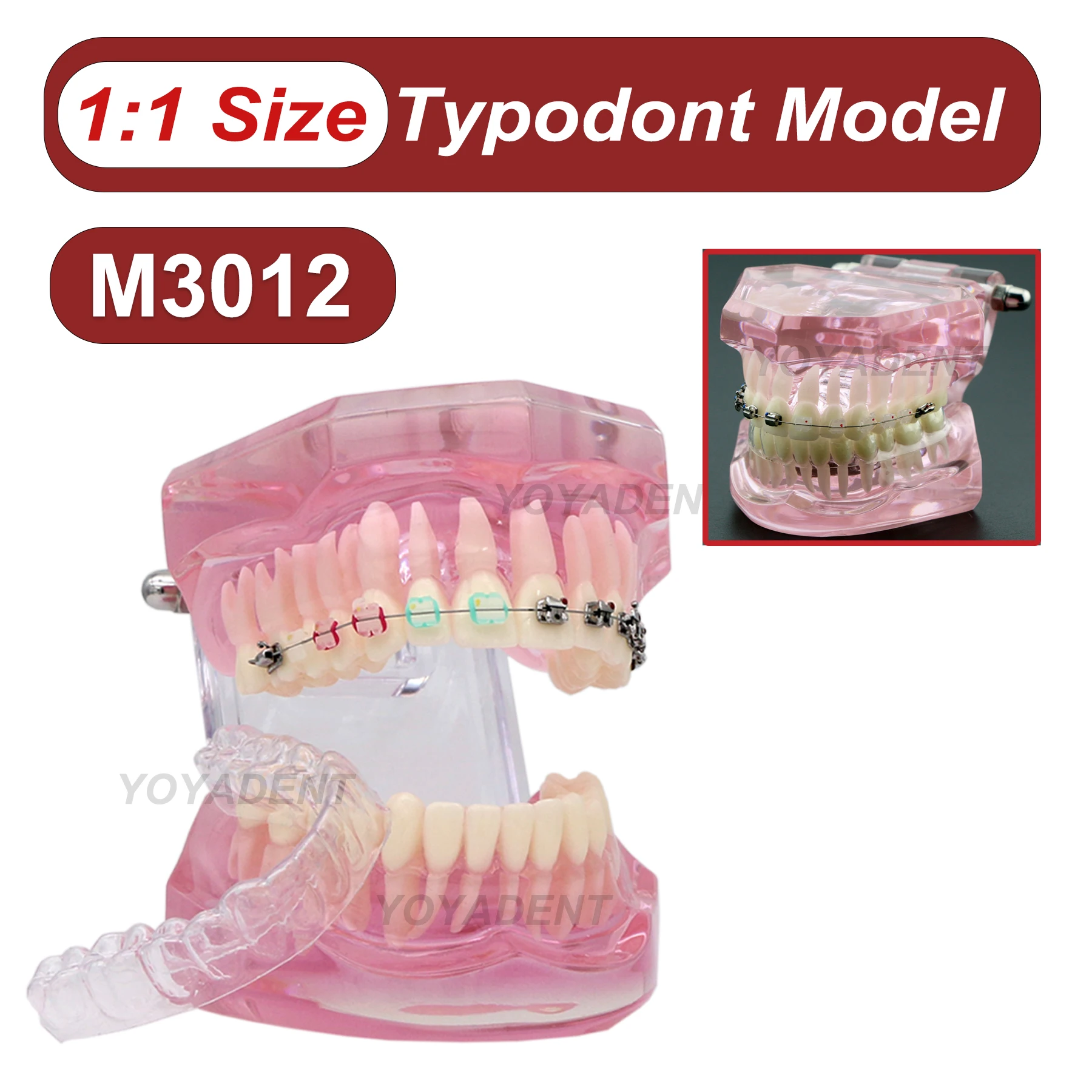 

Dental Teeth Model 1:1 Size Standard Typodont Model With Half Self-ligating Metal Brackets Dentists Teaching Demo Accessories
