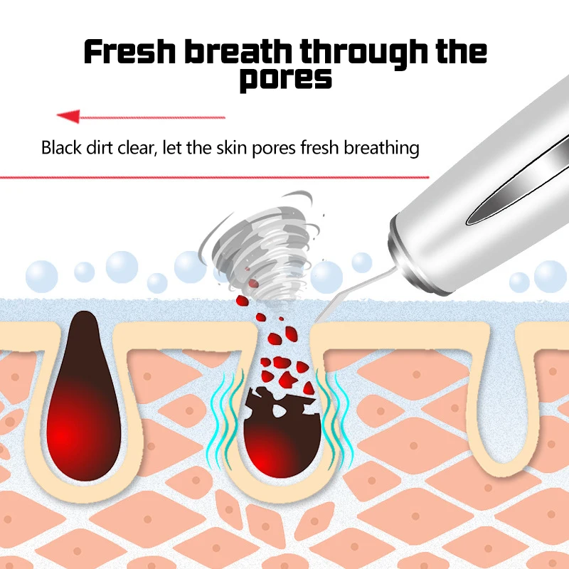 Ultrasonic Skin Deep Cleansing Machine Facial Acne Removal Rejuvenation Facial Massage Keratin Blackhead Lifting Beauty Device