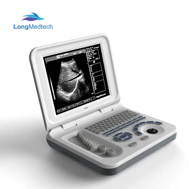 

Cheap Portable Echocardiography Laptop Ultrasound Scanner Machine China Electric CE USB Port 3d Scanner Price 1 Year,1 Year