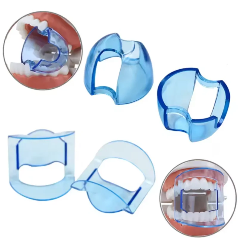 2pcs Blue anterior and posterior teeth opener, plastic oral support, orthodontic tool, disposable oral support