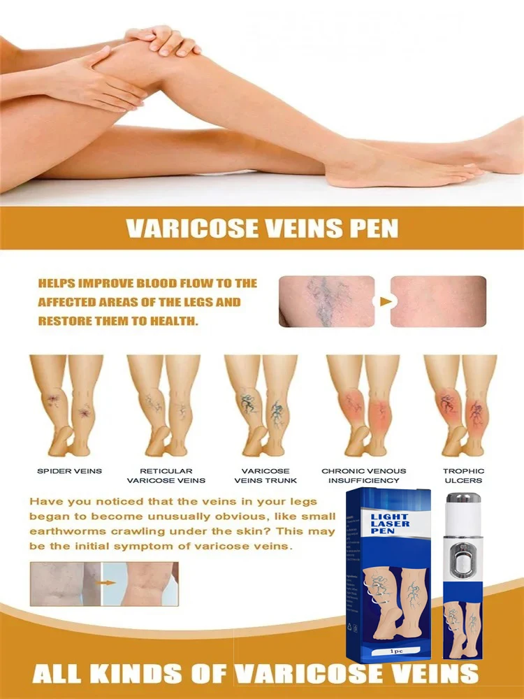 La Generation-2 Laser dit au revoir aux varices des jambes d'araignee خلال 7 أيام #5