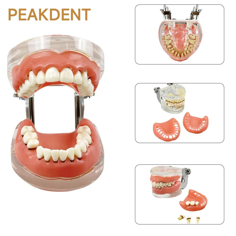 

Dental model tartar model suitable for laboratory medical science dental disease teaching and research