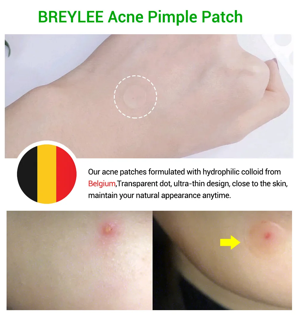 BREYLEE Acne Pimple Removal Patch Stickers Acne Treatment Mask Blemish Spot Cleaner Face Skin Care Tool Waterproof 22 Patches