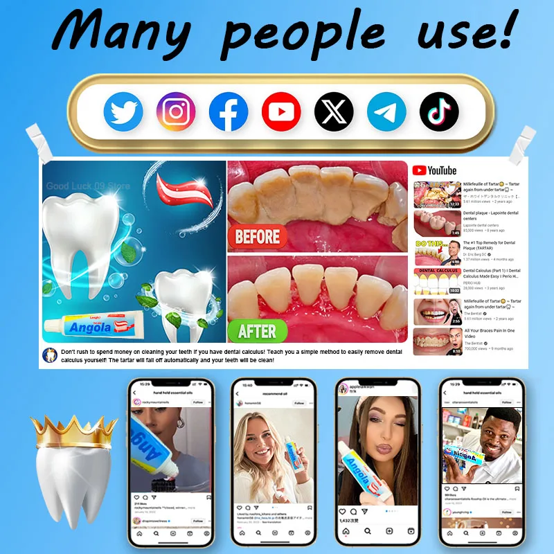 Dental Calculus Remover Whitening Removal Bad Breath Teeth Toothpaste Brightening Preventing Periodontitis Dental Cleansing Care