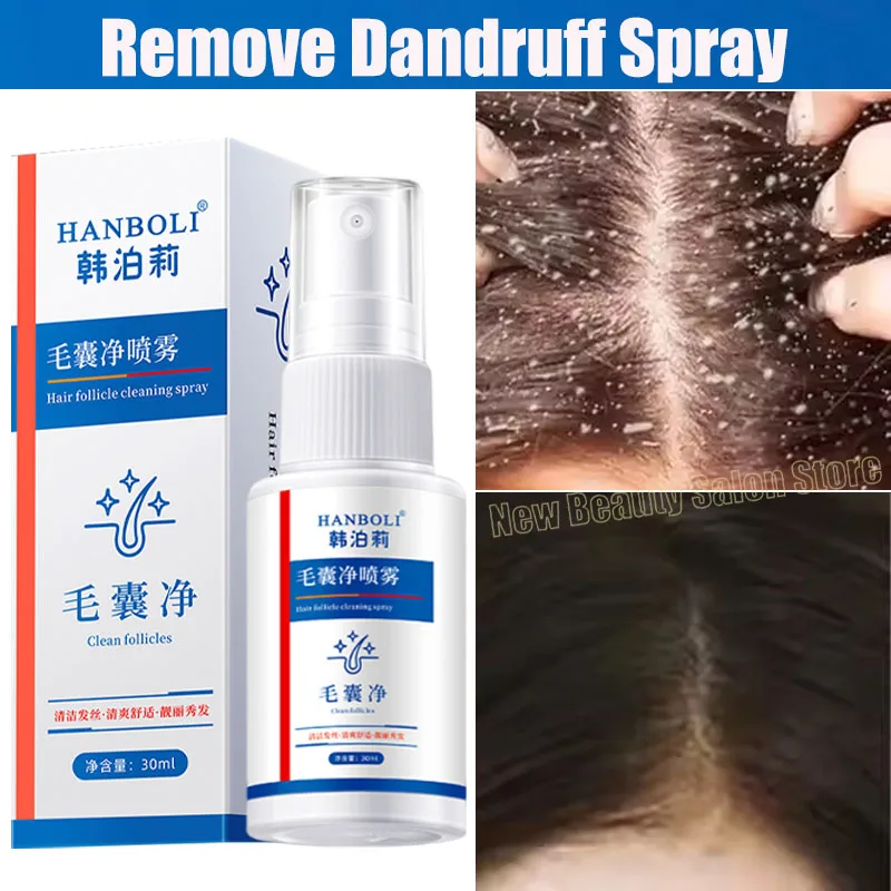 

Remove Dandruff Itching Spray Hair Scalp Treatment Oil Control Anti Loss Scalp Cleaning Repair Serum Beauty Hair Care Products