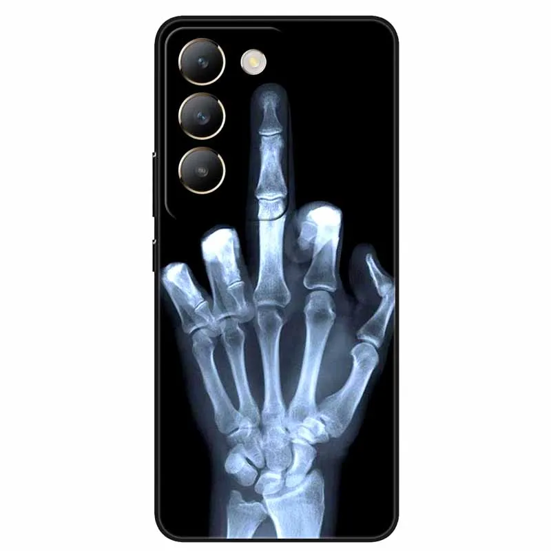 For Vivo V30 Lite 4G Case Cartoon Cool Wolf Silicone TPU Soft Phone Covers for Vivo V 30 Lite 4G V30Lite Shockproof Capa Animals